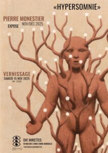 Hypersomnie